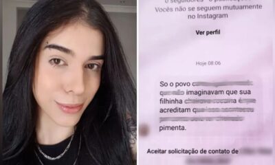 Jovem que quase perdeu a vida apos cheirar pimenta vem