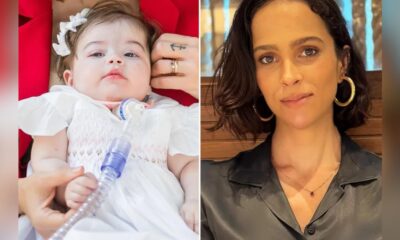 Leticia Cazarre fala das lesoes cerebrais que a filha desenvolveu