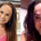 Empresaria expoe complicacao apos aplicacao botox caso serve de alerta