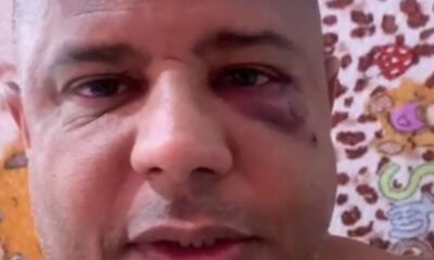 Marcelinho Carioca reaparece em video machucado confirma sequestro e diz