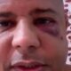 Marcelinho Carioca reaparece em video machucado confirma sequestro e diz
