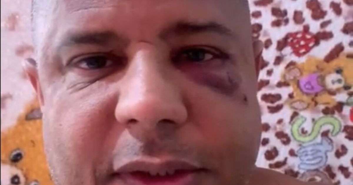 Marcelinho Carioca reaparece em vídeo machucado, confirma sequestro e diz qual foi o motivo 31 Marcelinho Carioca reaparece em video machucado confirma sequestro e diz