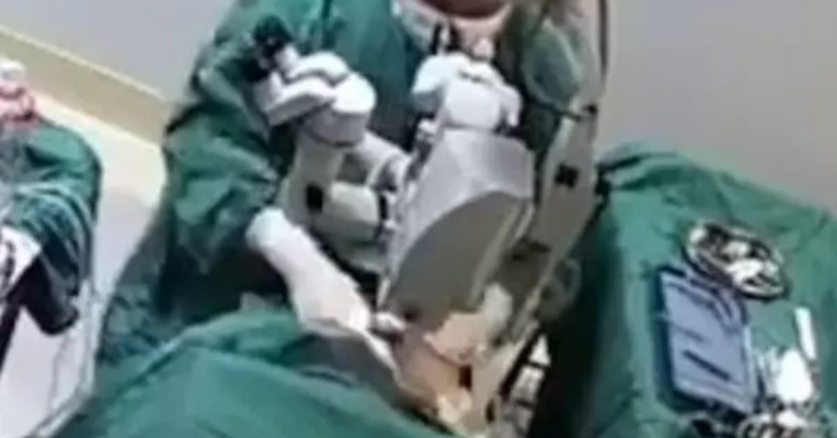 Medico da socos no rosto de paciente durante uma cirurgia