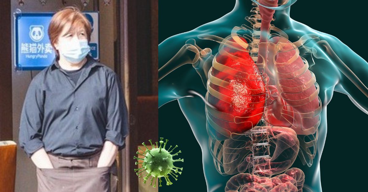 Nova pandemia? Surto de pneumonia na China gera preocupação mundial após aumento de casos na Europa 31 Nova pandemia Surto de pneumonia na China gera preocupacao mundial