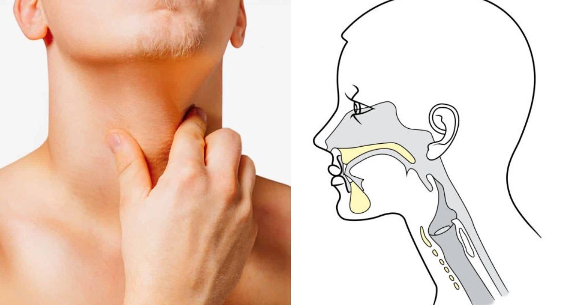Sensação de 'bolo' na garganta, como se algo estivesse preso? Diagnóstico pode ser mais simples do que você imagina 31 Sensacao de bolo na garganta como se algo estivesse preso