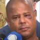 nao e facil ter revolver apontado a todo momento