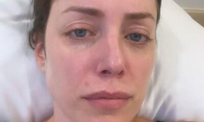 Fabiana Justus desabafa nas redes sociais em meio a tratamento