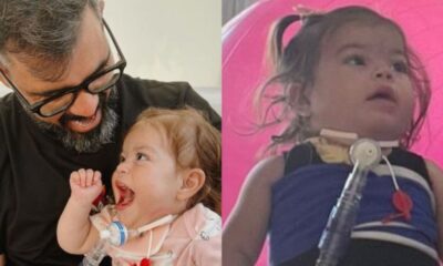 Filha de Juliano Cazarre que nasceu com condicao rara fica