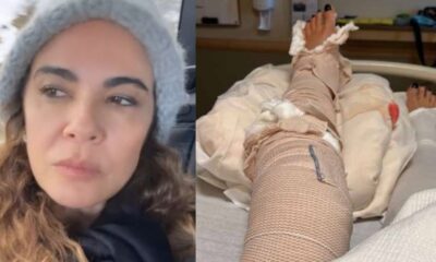 Um ano apos sofrer acidente grave Luciana Gimenez desabafa sobre