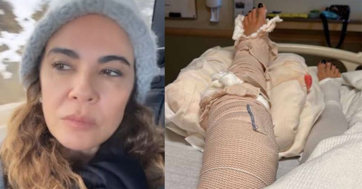 Um ano apos sofrer acidente grave Luciana Gimenez desabafa sobre