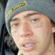 Apos revelar ter se afundado nas drogas Whindersson Nunes faz