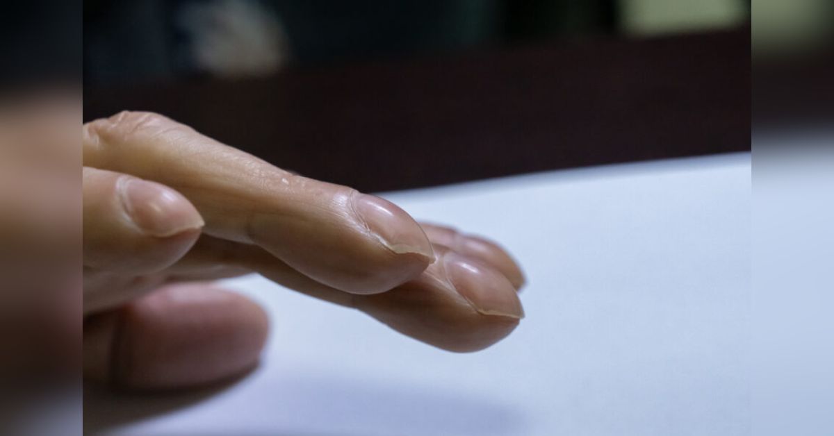 Estes sinais nas unhas pouco conhecidos não devem ser ignorados pois alertam para doença mortal 31 Estes sinais nas unhas pouco conhecidos nao devem ser ignorados