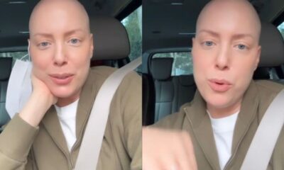 Fabiana Justus revela novo protocolo no tratamento contra o cancer