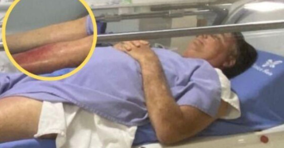 Internado e sem previsão de alta, estado de saúde de Bolsonaro requer cuidados: 'Não há' 31 Internado e sem previsao de alta estado de saude de