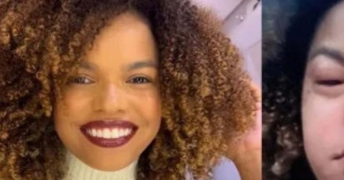 Jeniffer Nascimento fica irreconhecível após problema de saúde e deixa alerta: 'Muito cuidado' 31 Jeniffer Nascimento fica irreconhecivel apos problema de saude e