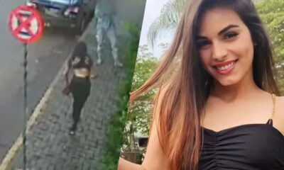 Jovem que foi atacada com acido no meio da rua