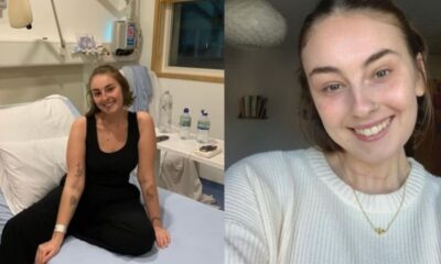 Jovem que pensava ter alergia a maquiagem descobre cancer muito