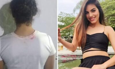 Policia prende suspeita de jogar acido em jovem ela confessou