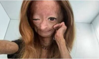 Youtuber de 15 anos que lutava contra grave doenca veio