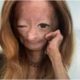 Youtuber de 15 anos que lutava contra grave doenca veio