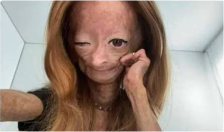 Youtuber de 15 anos que lutava contra grave doença, veio a óbito e fãs se despedem 31 Youtuber de 15 anos que lutava contra grave doenca veio