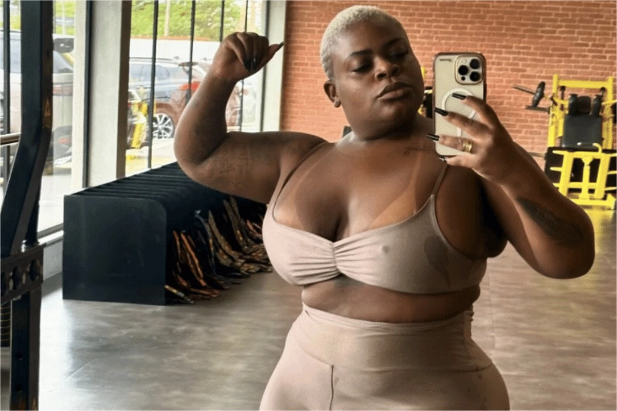 Após perder 50 kg, Jojo Todynho revela que passará por nova cirurgia: ‘Esse abdômen ia trincar’ 33 Apos perder 50 kg Jojo Todynho revela que passara por