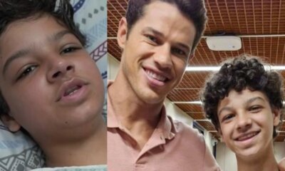 Ator mirim que sofreu grande acidente volta a Globo e