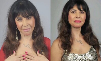 Atriz Claudia Alencar passa por nova cirurgia sete dias apos