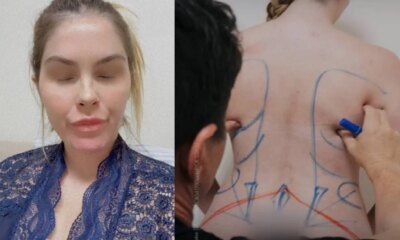 Barbara Evans passa por varias cirurgias plasticas de uma unica