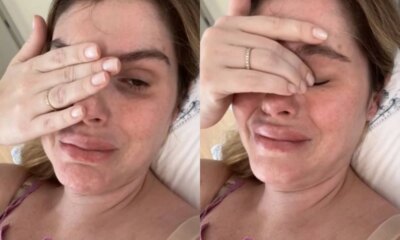Barbara Evans ve pus voltando em dreno de cirurgia plastica