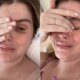Barbara Evans ve pus voltando em dreno de cirurgia plastica