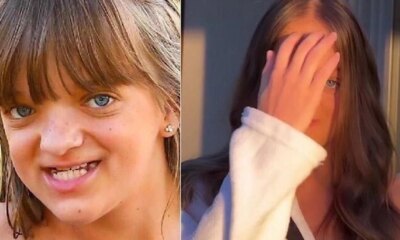 Criticada por realizar cirurgias plasticas no rosto aos 14 anos