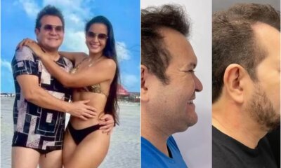 Esposa se derrete por Ximbinha e aprova harmonizacao facial do