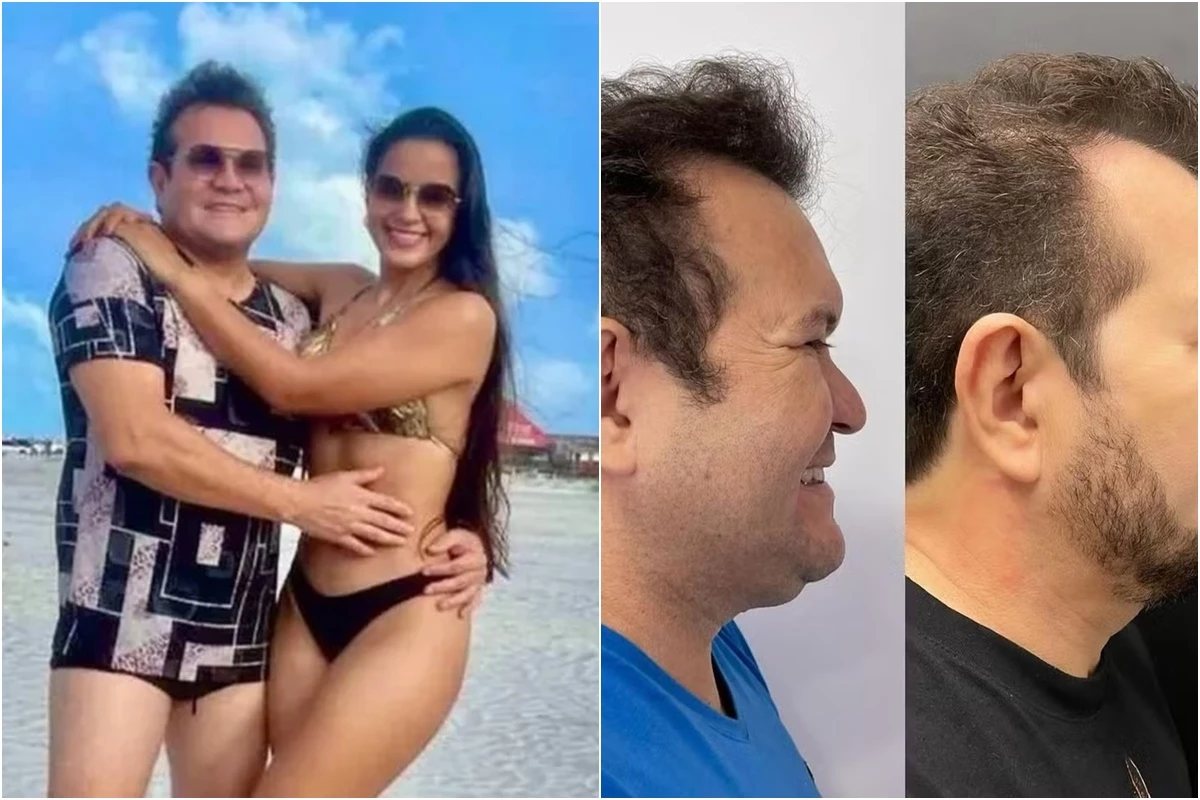 Esposa se derrete por Ximbinha e aprova harmonização facial do ex de Joelma: ‘meu marido está gato demais’ 33 Esposa se derrete por Ximbinha e aprova harmonizacao facial do