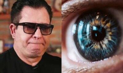 Marrone desenvolveu deficiencia visual ao perder parte da visao por