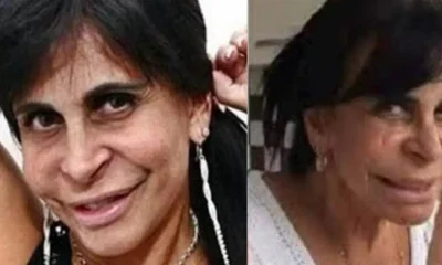 Tenho medo de ficar feia