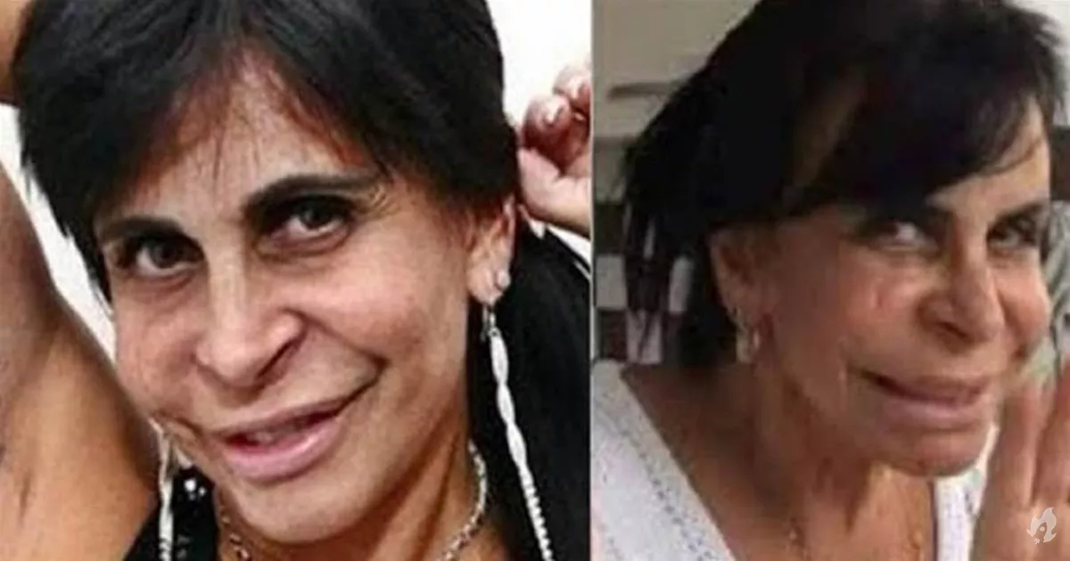 Tenho medo de ficar feia