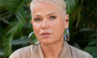 Xuxa passa por 80 procedimentos em 7 horas e expoe