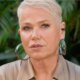 Xuxa passa por 80 procedimentos em 7 horas e expoe