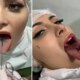 Andressa Urach desabafa apos cortar a lingua ao meio atraves