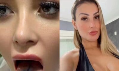 Andressa Urach passa por cirurgia para dividir lingua no meio