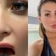 Andressa Urach passa por cirurgia para dividir lingua no meio