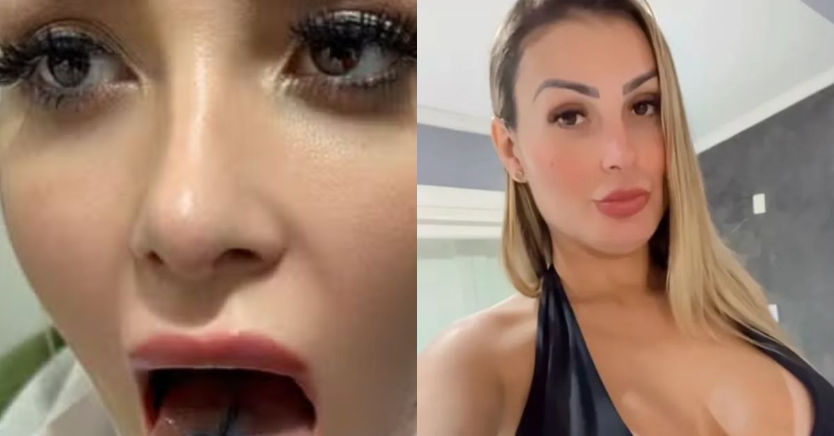 Andressa Urach passa por cirurgia para dividir lingua no meio
