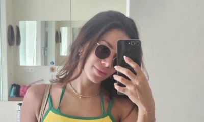 Anitta sofre acidente doloroso em viagem internacional ‘Tudo sangrando parei