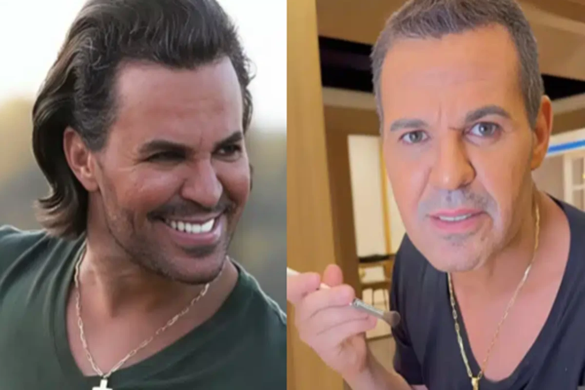 Após críticas, Eduardo Costa expõe o motivo da mudança no rosto e relembra o acidente que quase tirou sua vida 31 Apos criticas Eduardo Costa expoe o motivo da mudanca no