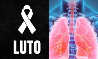 Luto doenca que matou influenciadora ‘Blogueirinha e comum e perigosa