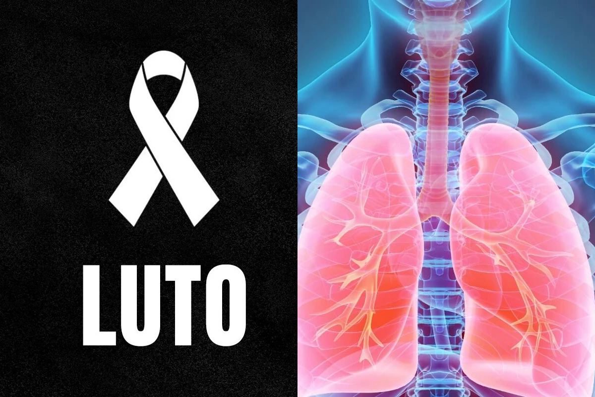 Luto: doença que matou influenciadora ‘Blogueirinha’ é comum e perigosa 33 Luto doenca que matou influenciadora ‘Blogueirinha e comum e perigosa