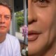 Marcello Antony faz harmonizacao facial e resultado deixa internautas boquiabertos