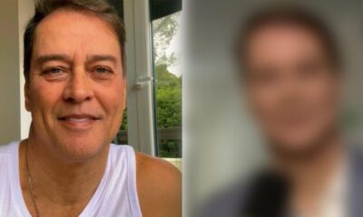 Marcello Antony faz harmonizacao facial e vira assunto nas redes