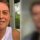 Marcello Antony faz harmonizacao facial e vira assunto nas redes